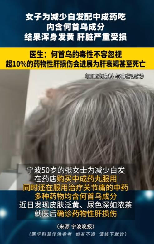 “药不能乱吃！”8月21日报道，浙江宁波，一女子为了减少头上白发，自己去药店买了