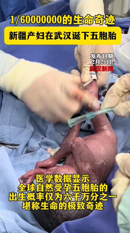 看看，这位爸爸能闯多大的祸！这位5胞胎妈妈是自然受孕，新疆人，在武汉刚刚生产完