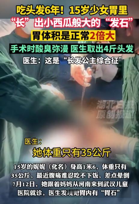 河南一女孩因腹痛吃不下饭，去医院看病，不料，医生竟从她的胃里，发现一颗堪比小西瓜