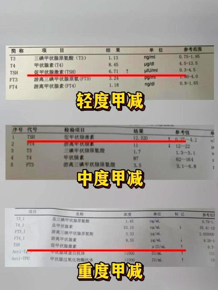 一张报告单，终于给我最近的「不对劲」找到了凶手。那个叫TSH的玩意儿，数值