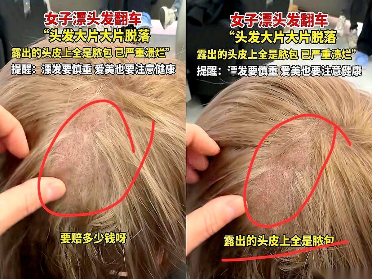 上海那个染头发的姑娘，新闻你们刷到了吗？理发师一掀开她头发，底下根本不是头皮了