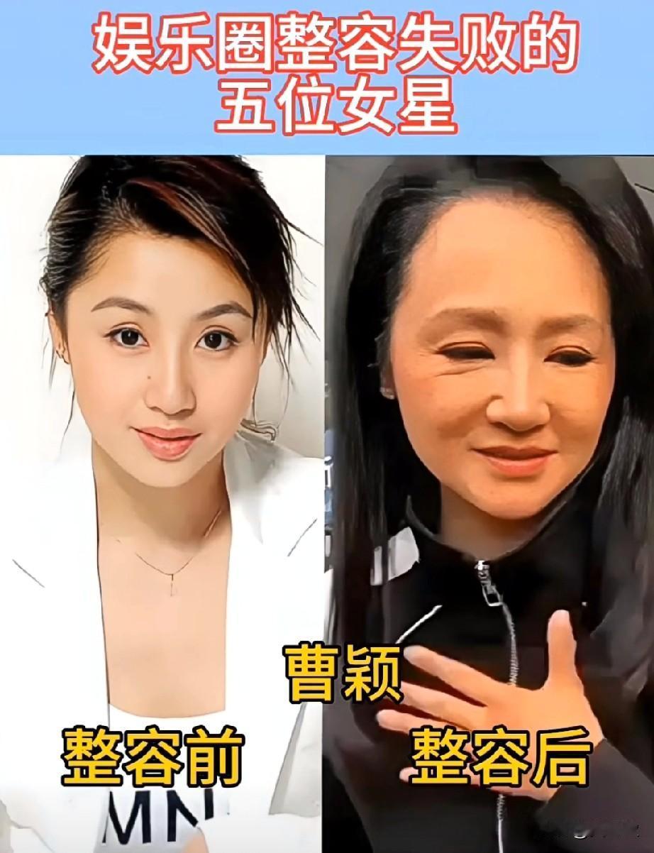 娱乐圈整容失败的五位女星你们说哪一位变化最大？