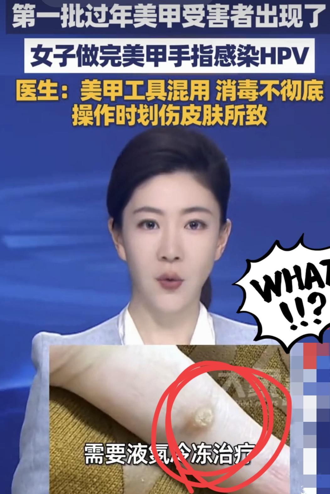 没想到啊，美甲还能感染HPV昨天女儿还说空了要出去美甲我不同意‼️看