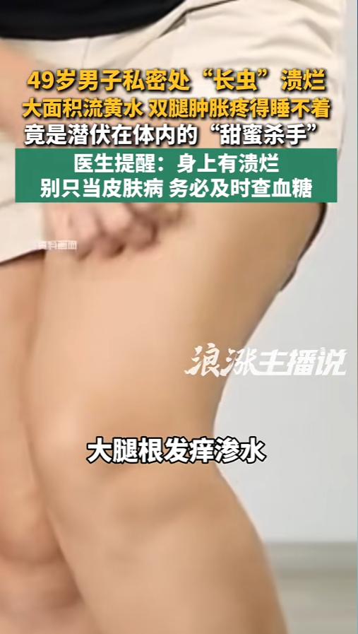 “太吓人了！”6月18日报道，广东深圳，一男子遭受了难言之隐，自己的私处竟然出了