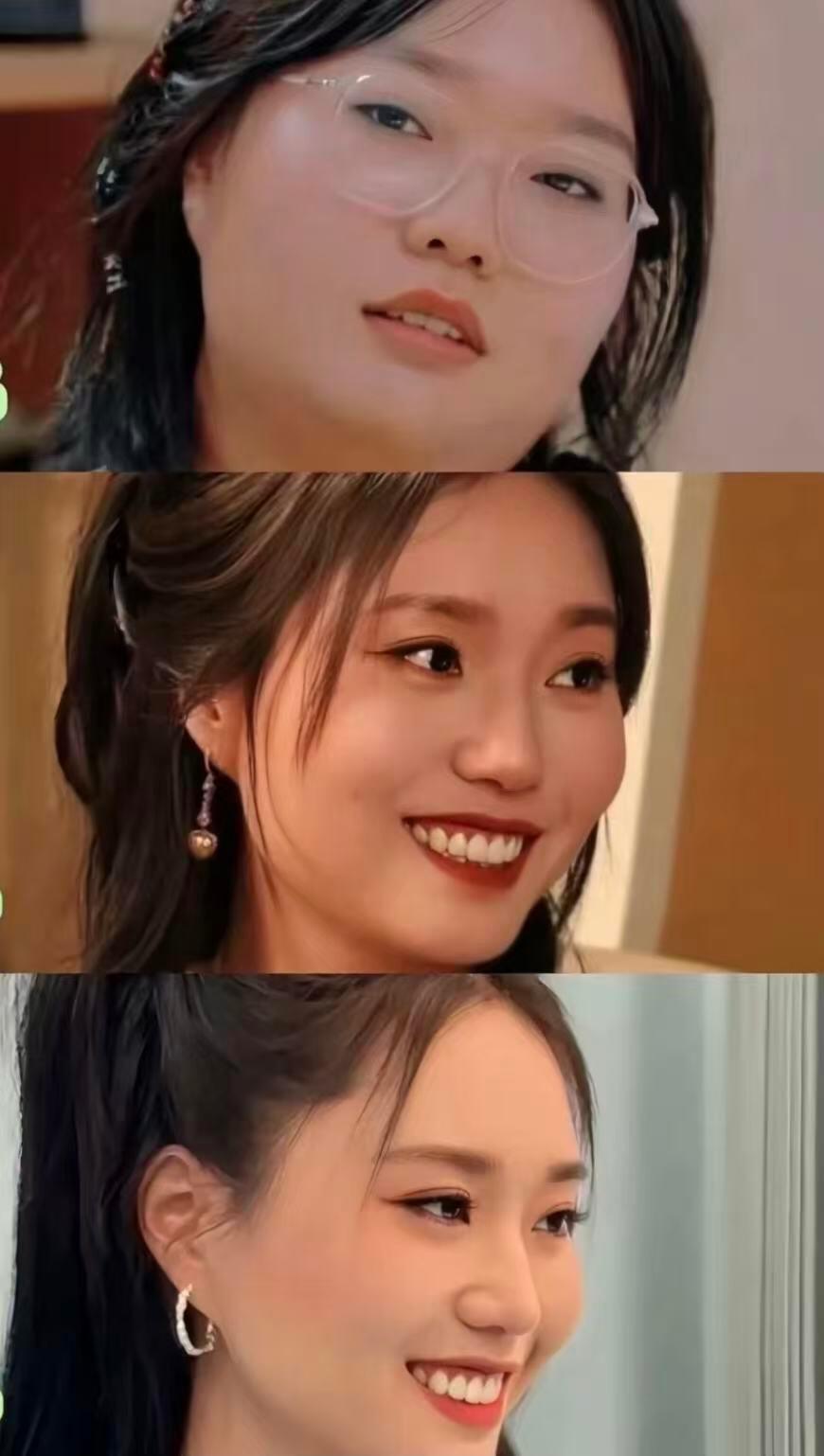 李雪琴瘦了之后双眼皮都变明显了，瘦下来之后才知道她底子这么好