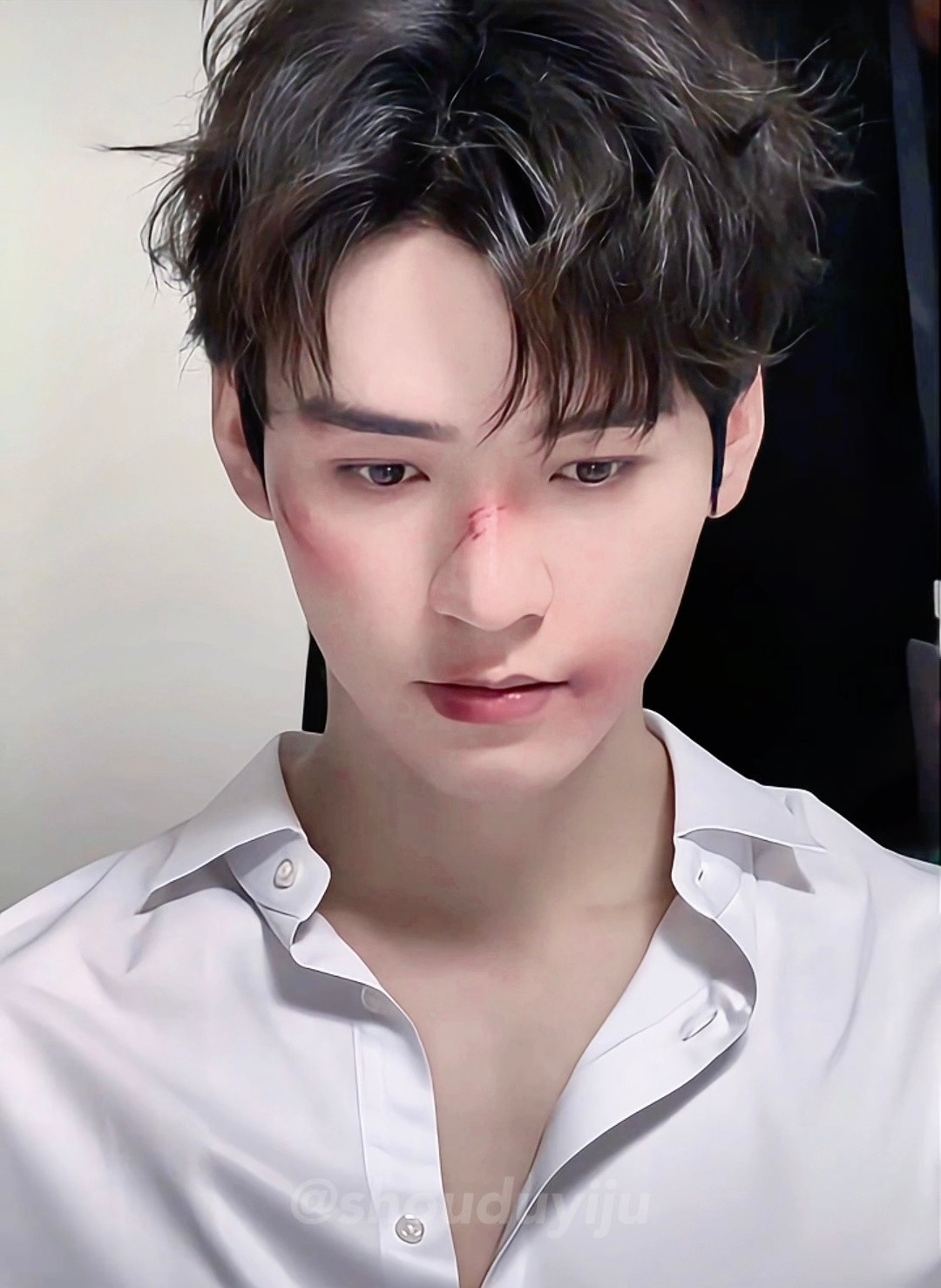 战损小狗🐶龚俊就这样用无辜的眼神看着我🥹​​​