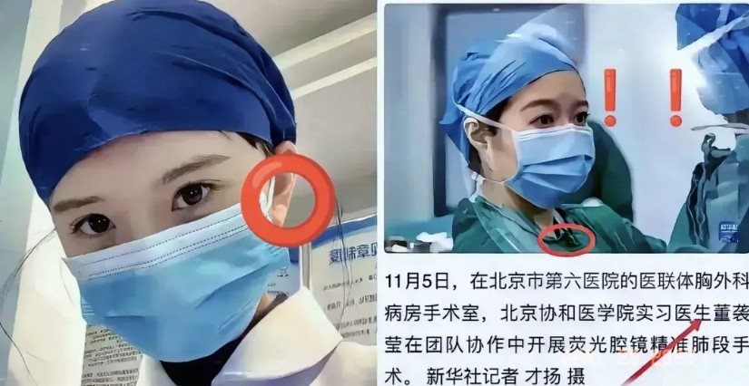我问我舅妈，说中日友好医院董医生上了新闻，舅妈说不太正常。正常情况下，一个医