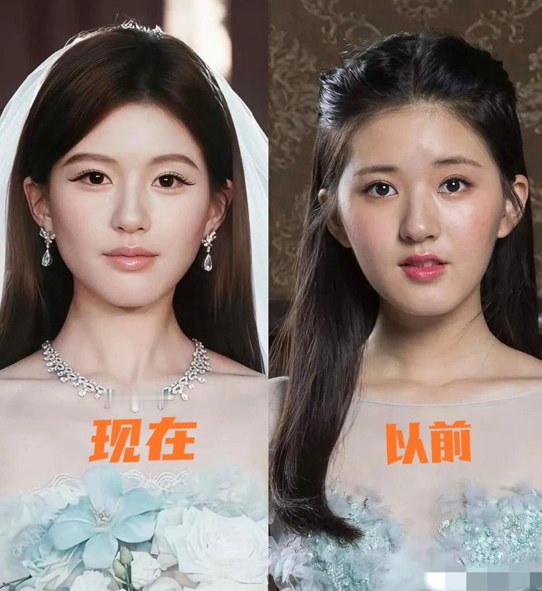 看赵露思现在和以前的照片，变化还蛮大的！眼睛变细长了，嘴巴变大了，嘴形也不一样了
