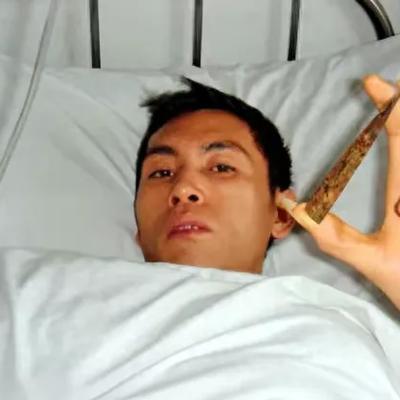 2011年，云南省某人民医院，一男子说自己一天刷十次牙，但一张嘴就是伴着铁锈的恶