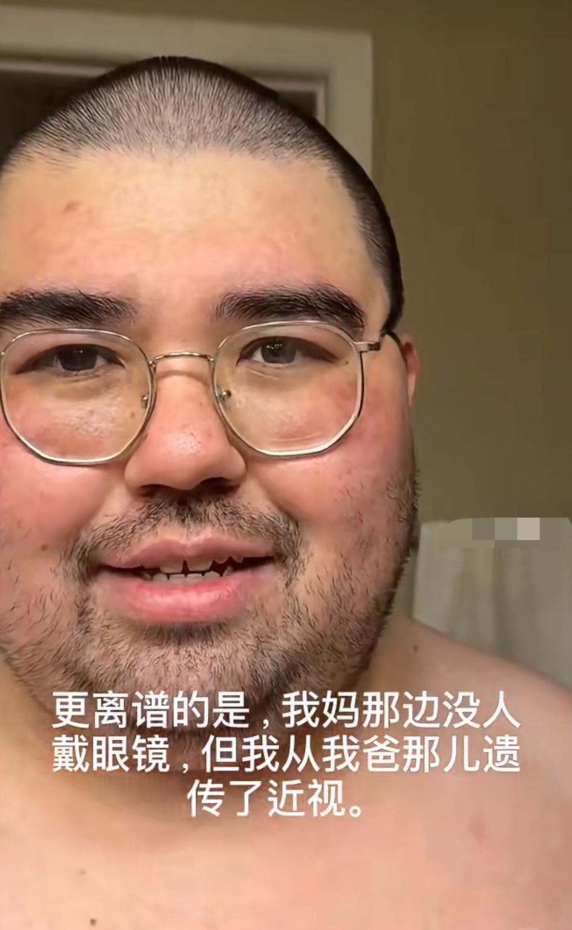 混血儿吐槽自己精准的遗传了坏基因，他爸爸身高1.82米，而他只有1.68，长得又