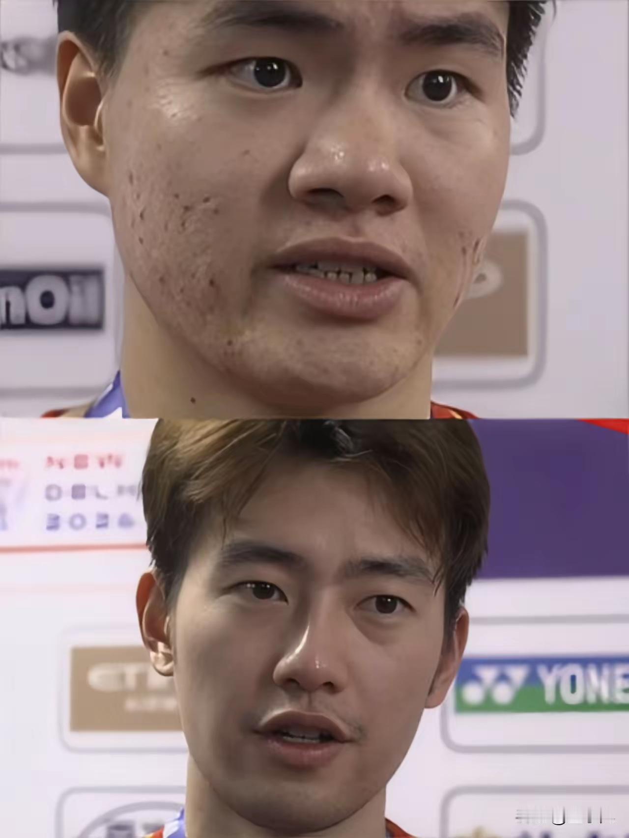 谁能帮帮梁伟铿这张脸啊！你看孩子这是不是内分泌失调的原因呢？王昶的脸油光水滑，不