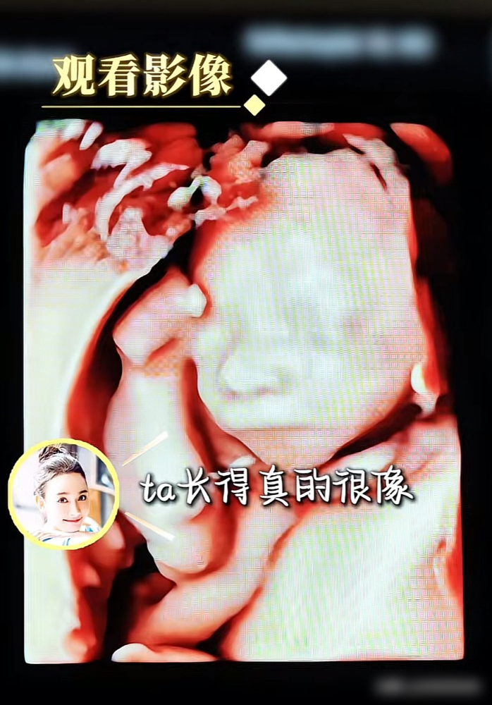 41岁高龄拼二胎，产检时老公全程陪着，还一口一个妈妈叫着，这画面没点阅历真看不懂。10月11日，孙骁