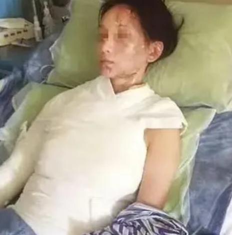 🐰"这就是嘴欠的下场"！一盆滚烫高汤从头顶浇下，28岁温州姑娘林某姣好的