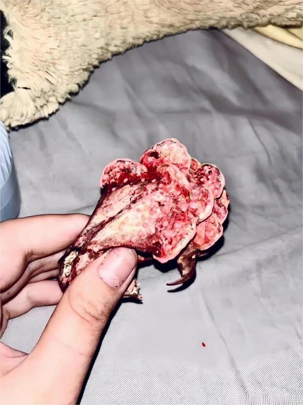 剖腹产为什么要坐月子？