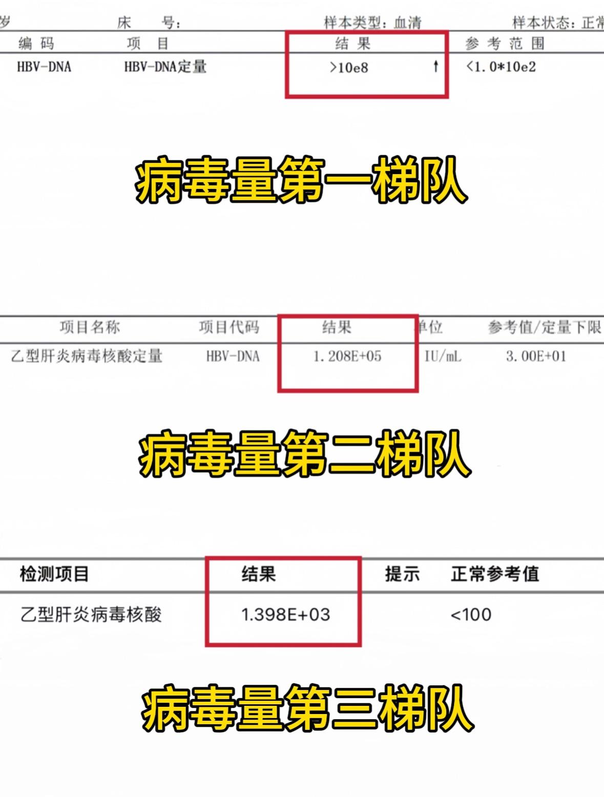 乙肝病毒量怎么看？1分钟教会你！。许多患者留言：乙肝病毒多少不会看，不...