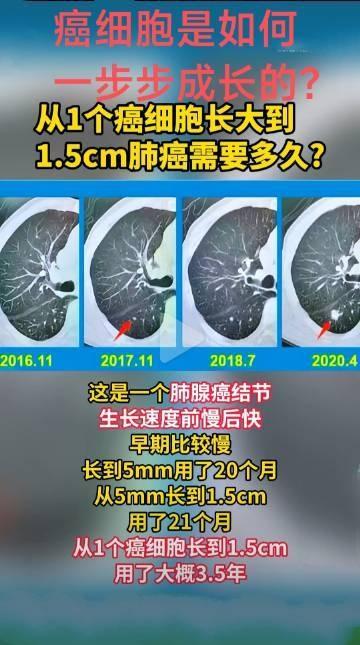 癌细胞是如何一步一步长大的？​​​一般而言，癌细胞刚开始发展比较缓慢，后期会爆