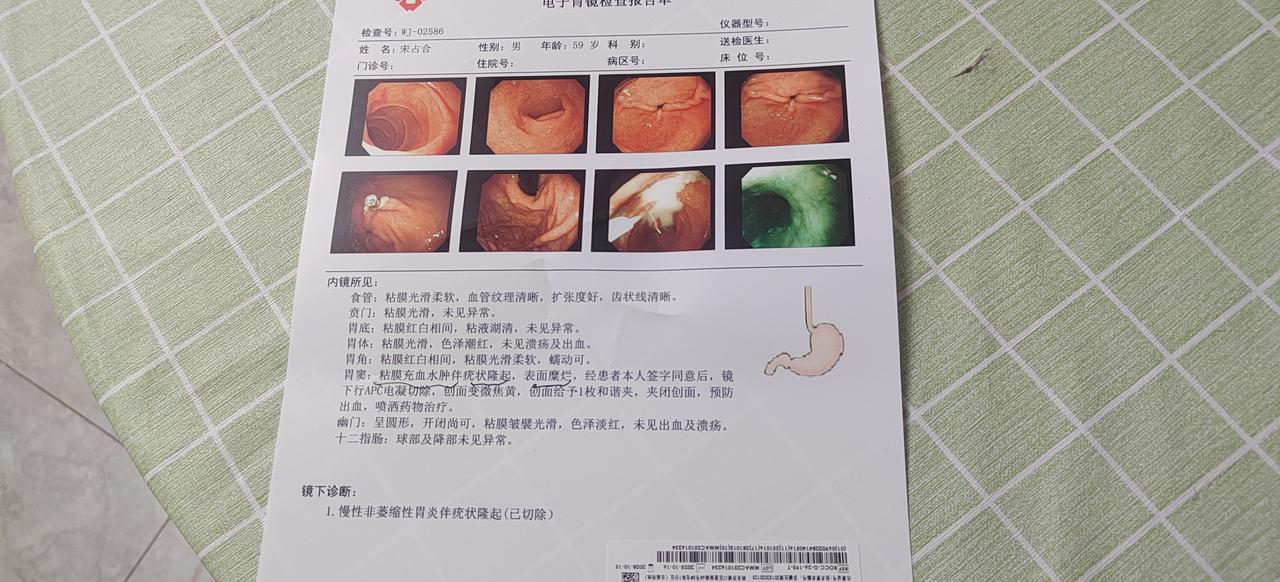 这几天我看到有无痛肠镜胃镜，我很感兴趣。因为我的肠道一直不好，而且小腹总是疼痛。