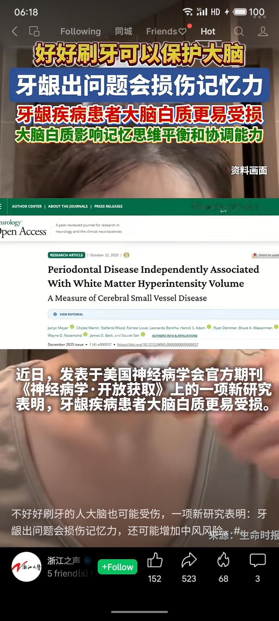 美国神经病学会期刊最新研究表明，牙龈疾病与大脑白质损伤密切相关，患者出现脑损伤的