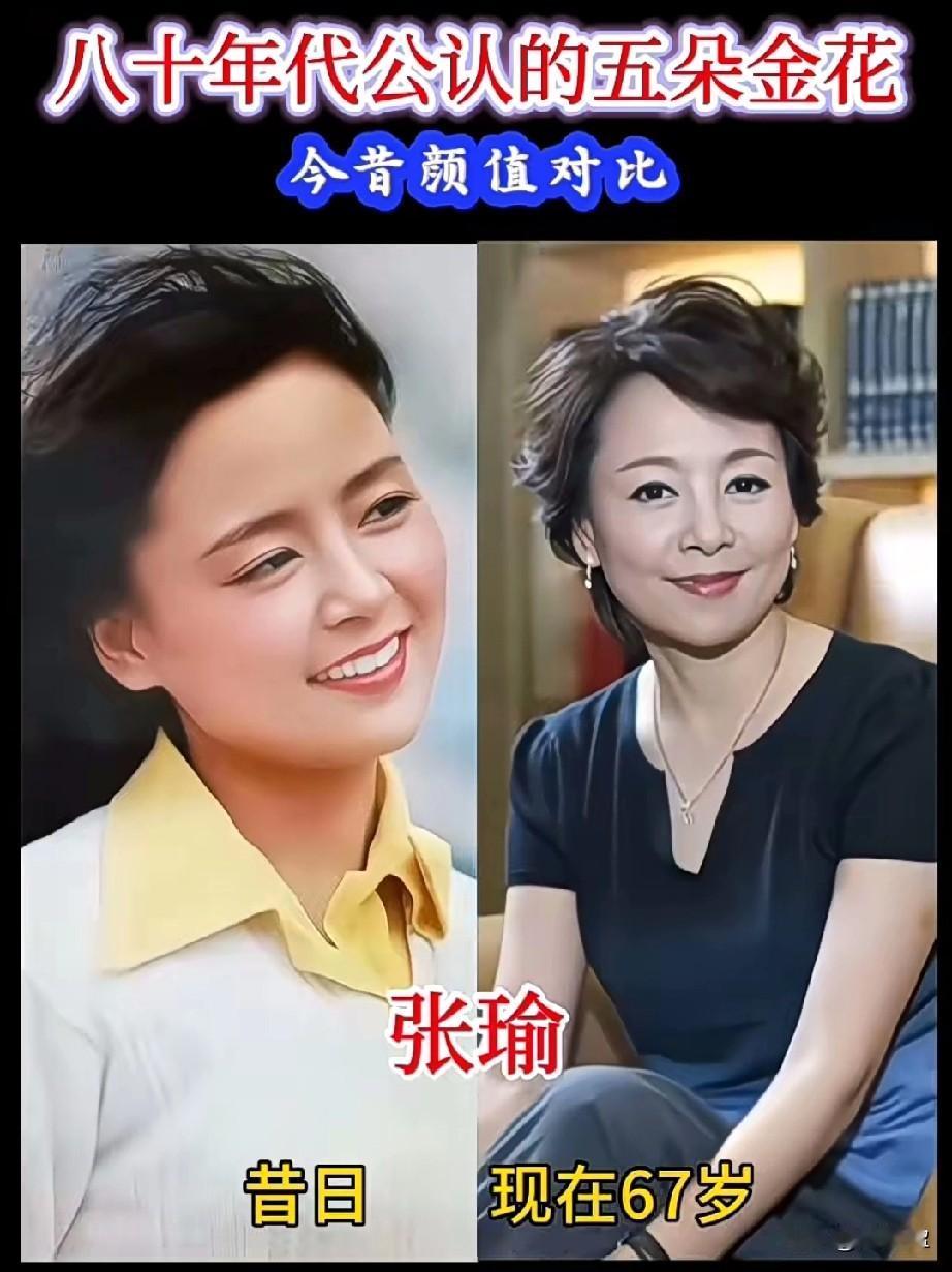 80年代公认的5朵金花今昔颜值对比，你觉得谁的变化最大？