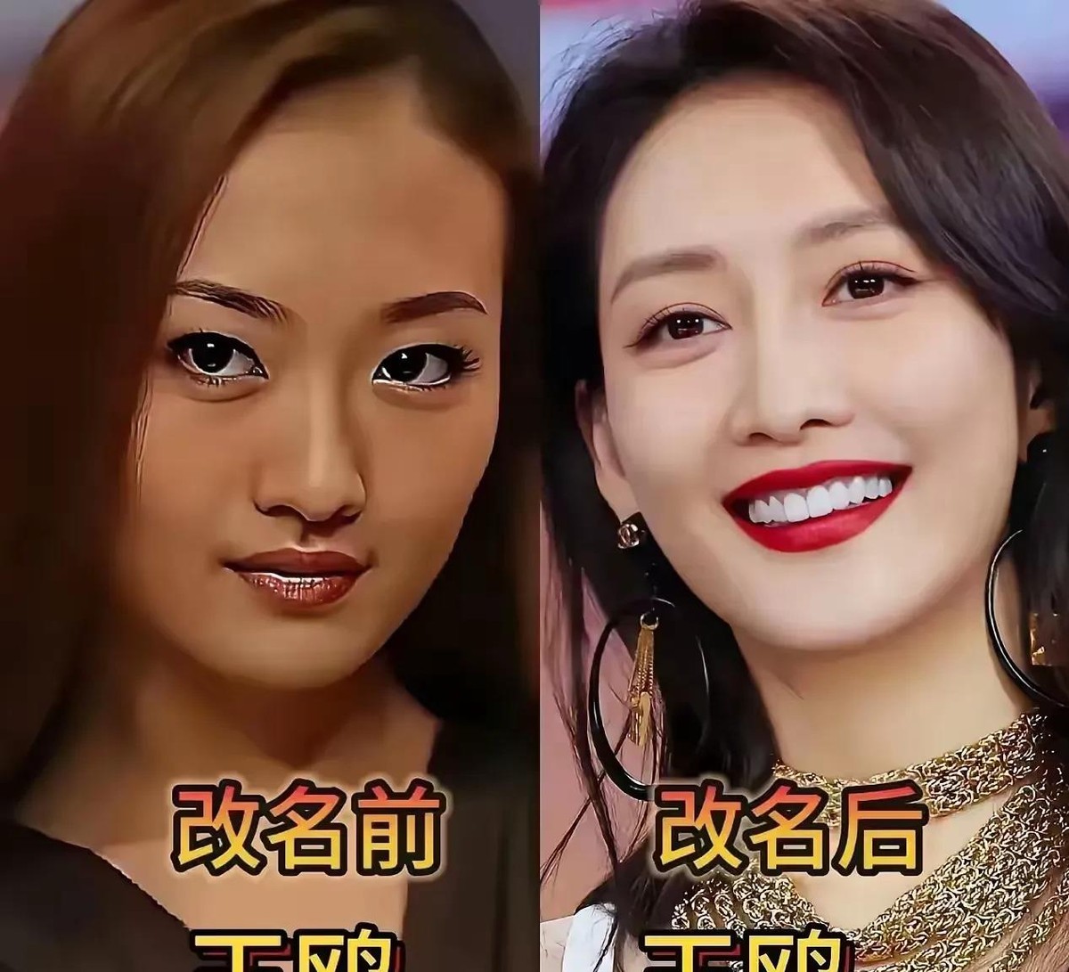 吉克隽逸原名王俊逸，改个名而已，怎么连脸都像重新投了胎？当年她参加快女时叫王隽逸，皮肤没现在这么黑，