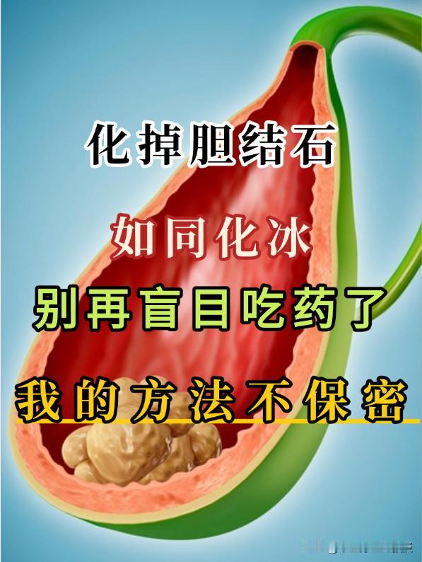 化掉胆结石没有再犯过，不要再傻乎乎吃药了，我的方法，不保密！胆囊在我们身体里