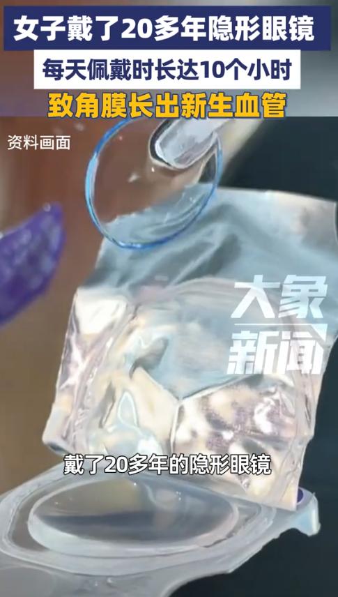 “悲剧还是发生了！”河南郑州，一位38岁女子因高度近视，戴了20多年的隐形眼镜，