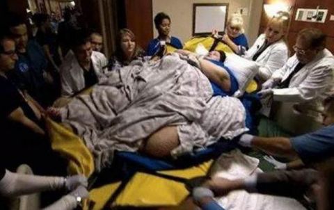 六百斤孕妈生产, 接生医生看到生下的孩子后, 瞬间惊出冷汗!