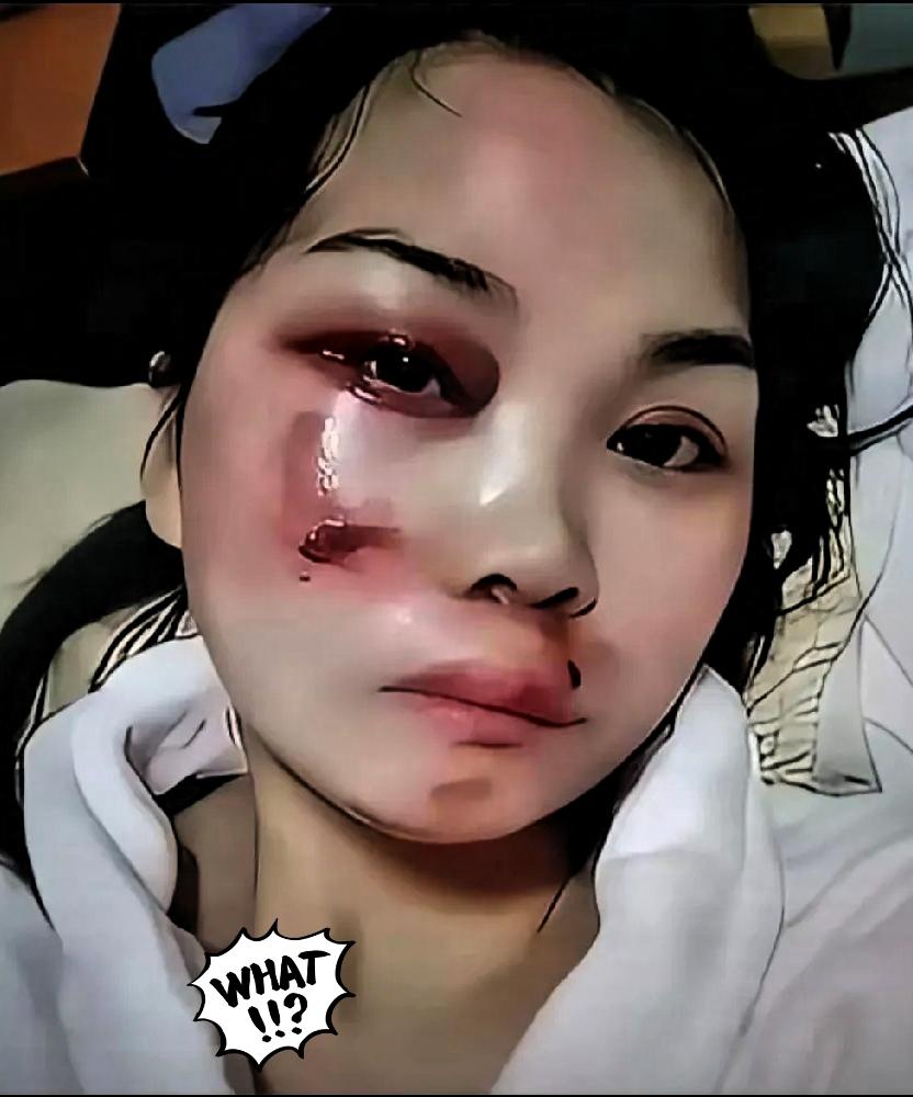 家暴别忍！这次必须刚到底！家暴这事绝不能忍！就说这次事件，女方被男方打断两