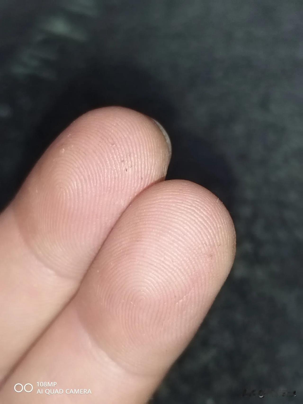 28岁确诊二型糖，一晃眼，40岁了。完结了6本小说，才发现忘记是糖人了。赶紧