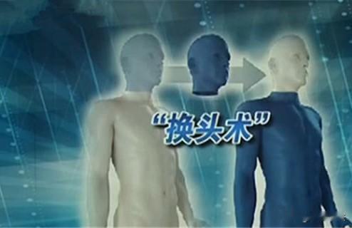 全球首例“头颅移植手术”简介！全球首例人类头部移植手术并非在活人身上成功，而