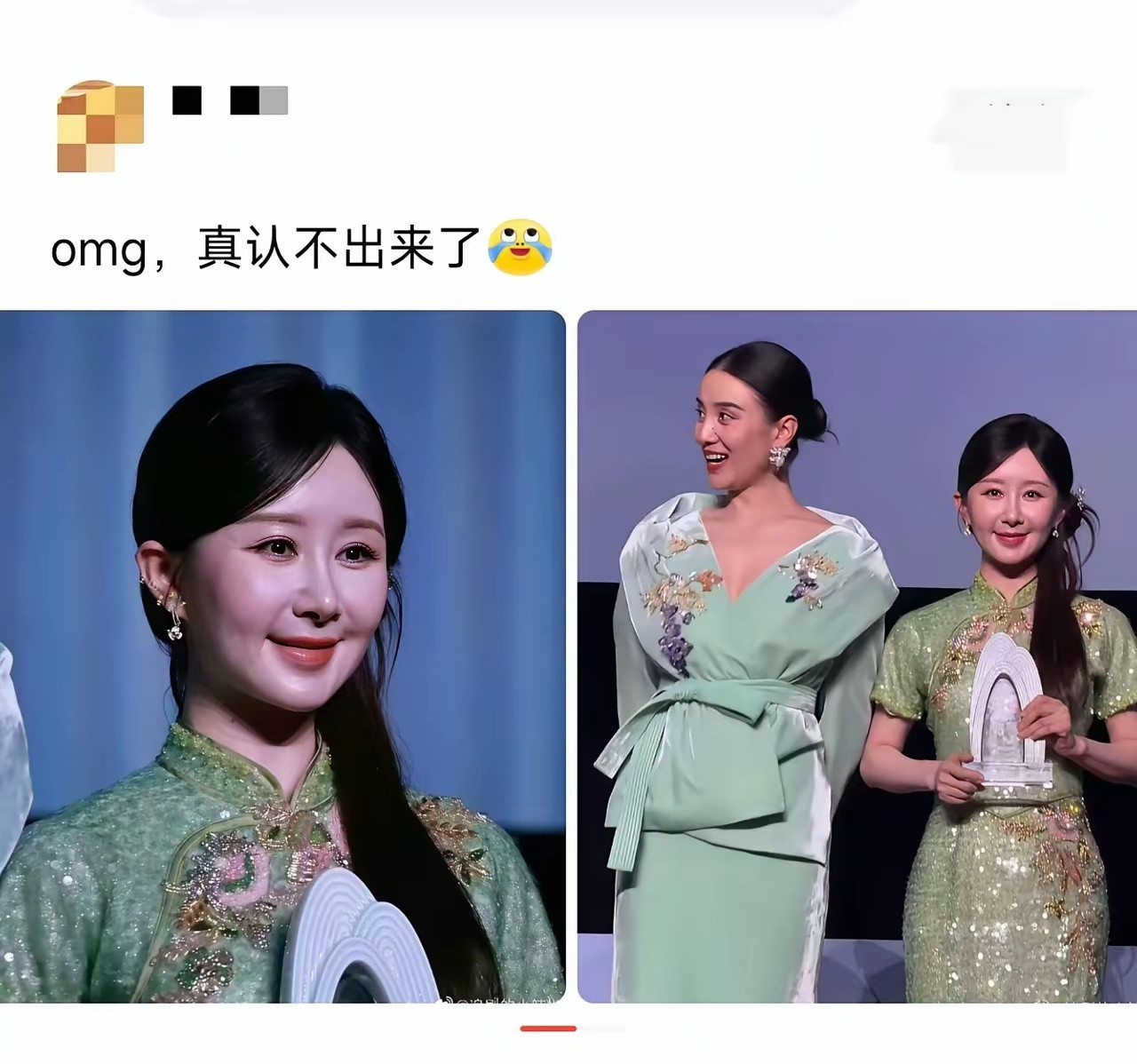 这是做了医美吗？都不认识了​​​