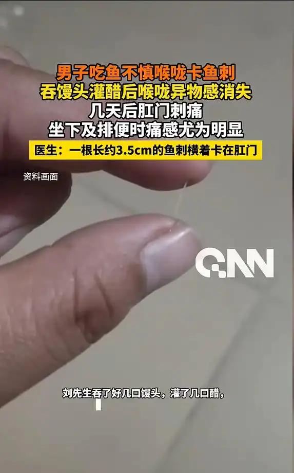 听着都疼！河南郑州，男子在家里吃鱼时不慎卡了一根鱼刺，他就想着用老方法，吃点馒头