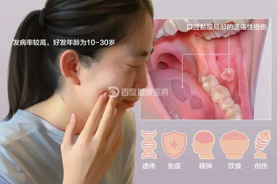 免疫系统的异常主要表现在以下几个方面：T淋巴细胞亚群失衡患者外周血中CD4+