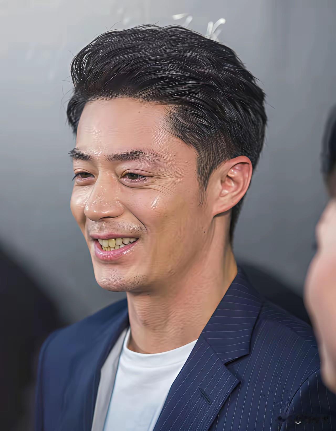 我突然发现好多明星是上了年纪才做烤瓷牙怪总比丑好这也就是为什么烤瓷牙这么假