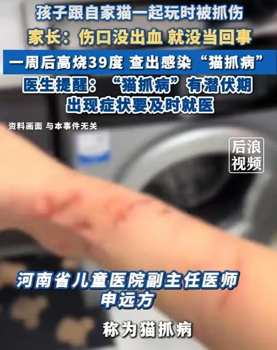 河南郑州，一名12岁的男孩在家中和宠物猫玩耍时，脸上被猫咪尖牙扎出三处细小伤口。