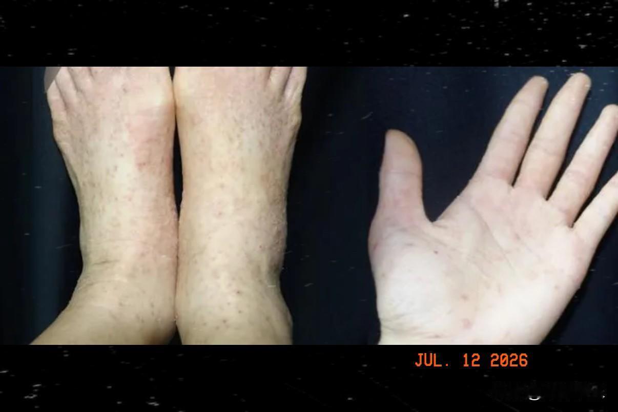 浙江杭州一名27岁年轻女孩小卢，去年夏天和男朋友出门短途游玩，为了方便省钱，在当