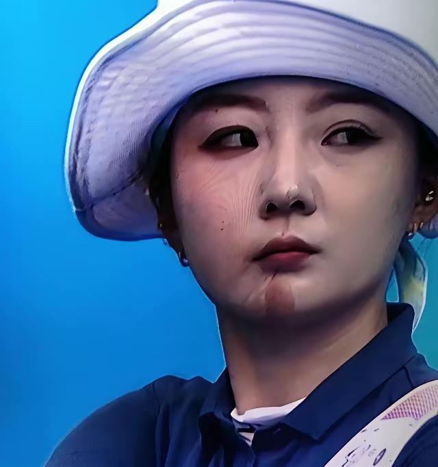 北京一射箭女运动员比赛时被弓弦刮掉粉底，下巴和鼻尖露出了原肤色，看着像受伤了，其