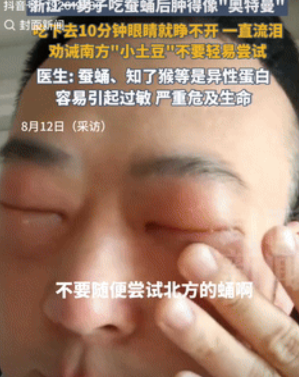 “万万想不到！”浙江一男子因嘴馋，买了些蚕蛹回家吃，不料吃下去仅10分钟，眼睛就