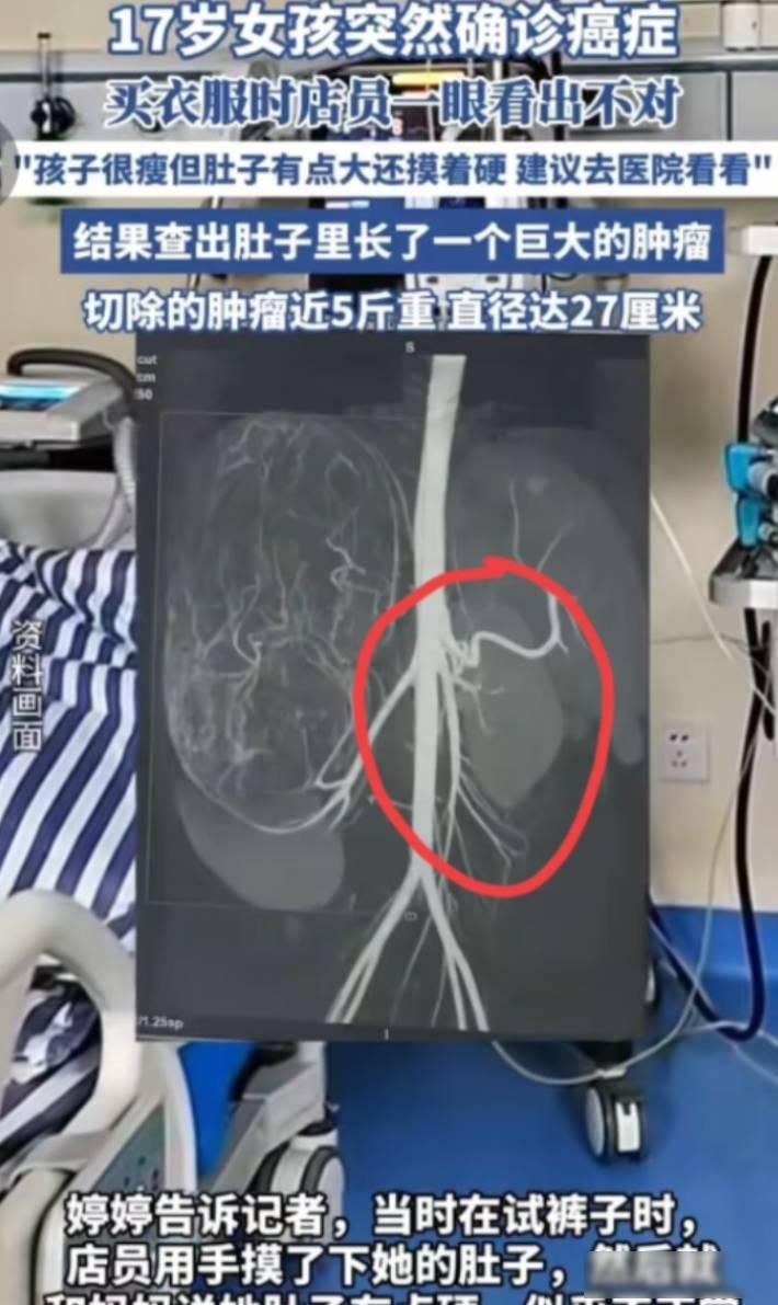 “幸亏发现了！”17岁的小婷怎么也没想到，和妈妈去商场试裤子，会惹出这么大的事，