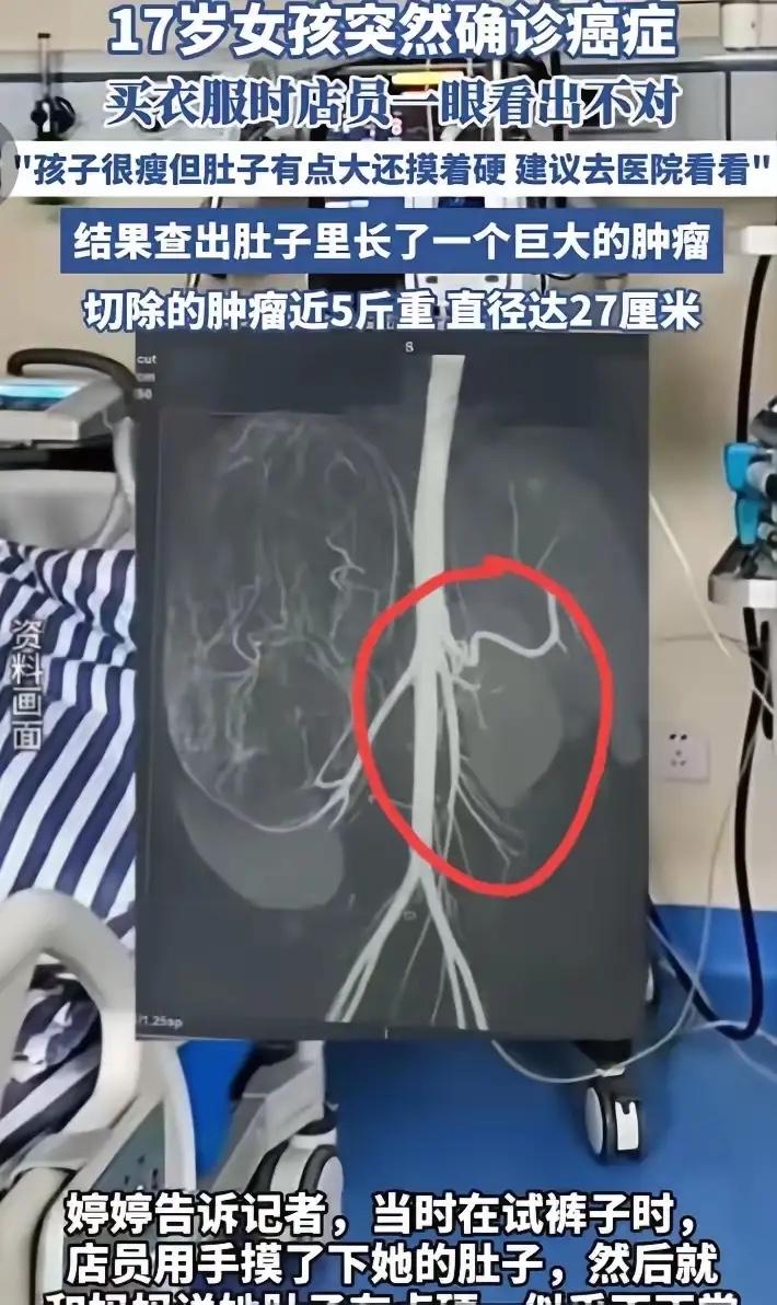 2025年6月，广东17岁女孩和妈妈一起逛街买衣服，谁知，当女孩在店里试裤子时，