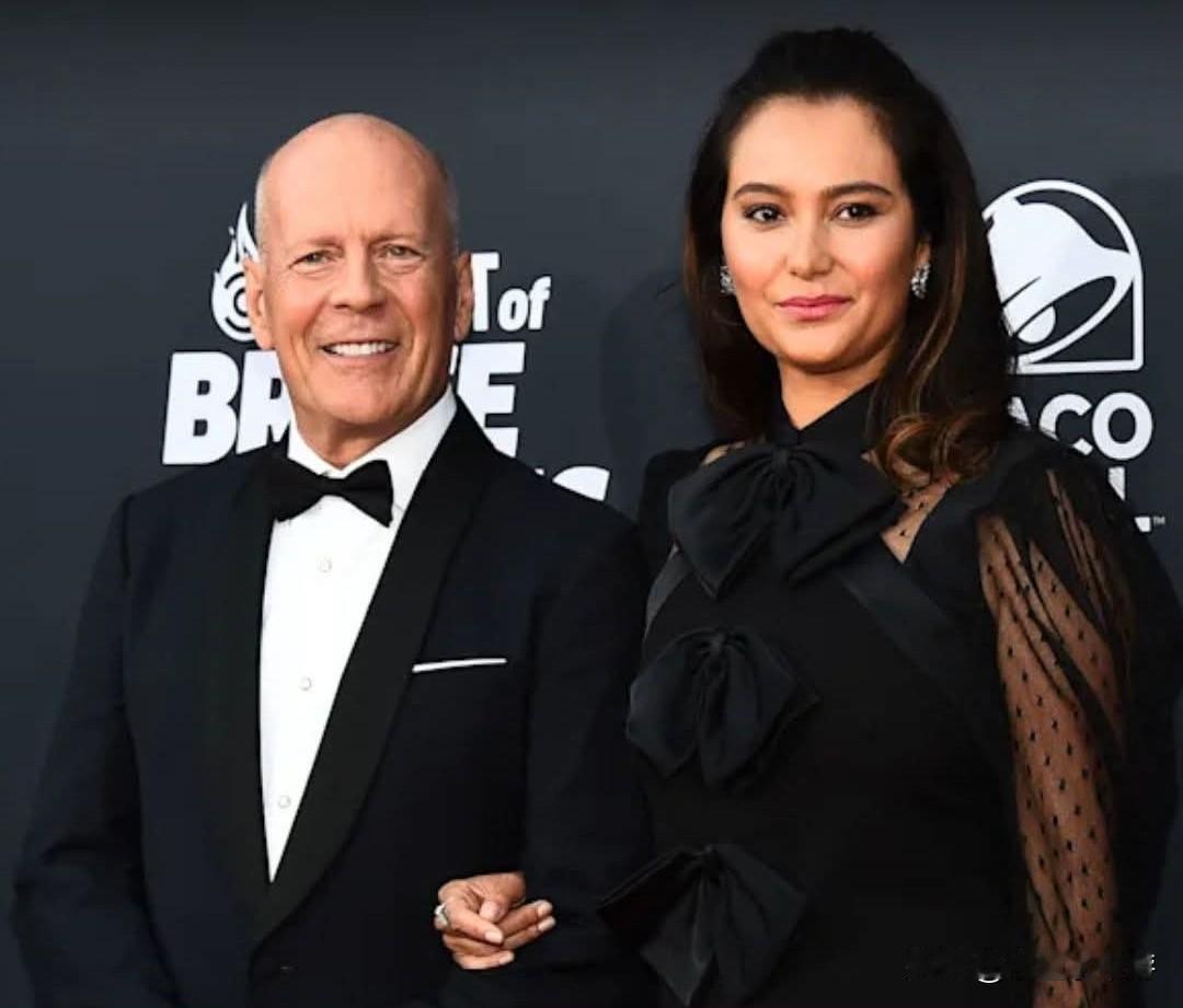 好莱坞演员布鲁斯威利罹患额颞失智症（FTD）和失语症，目前已经息影，他的47岁妻