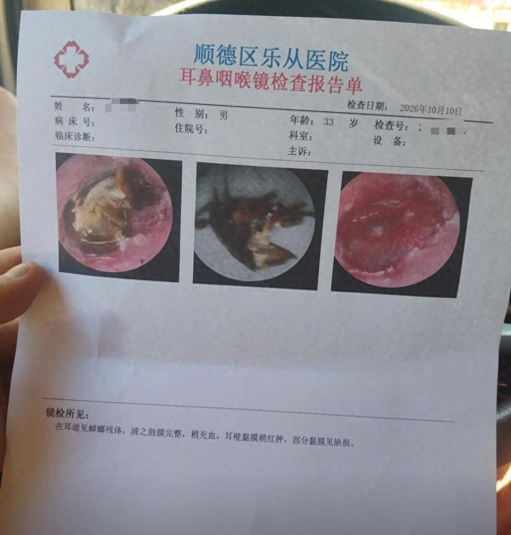 广东韶关，33岁男子回老家探亲，深夜睡梦中突觉左耳有虫在爬，伸手一抓竟被它挣脱直