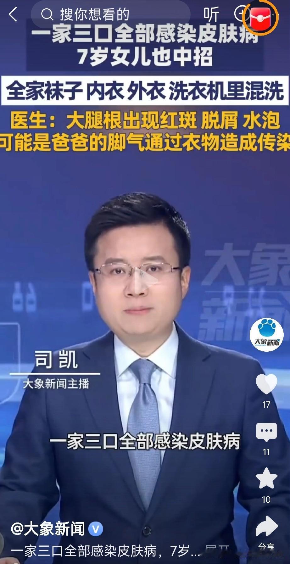 有混洗衣物习惯的人注意了河南郑州一家三口身上全冒红疹，大腿根还出现红斑、脱屑