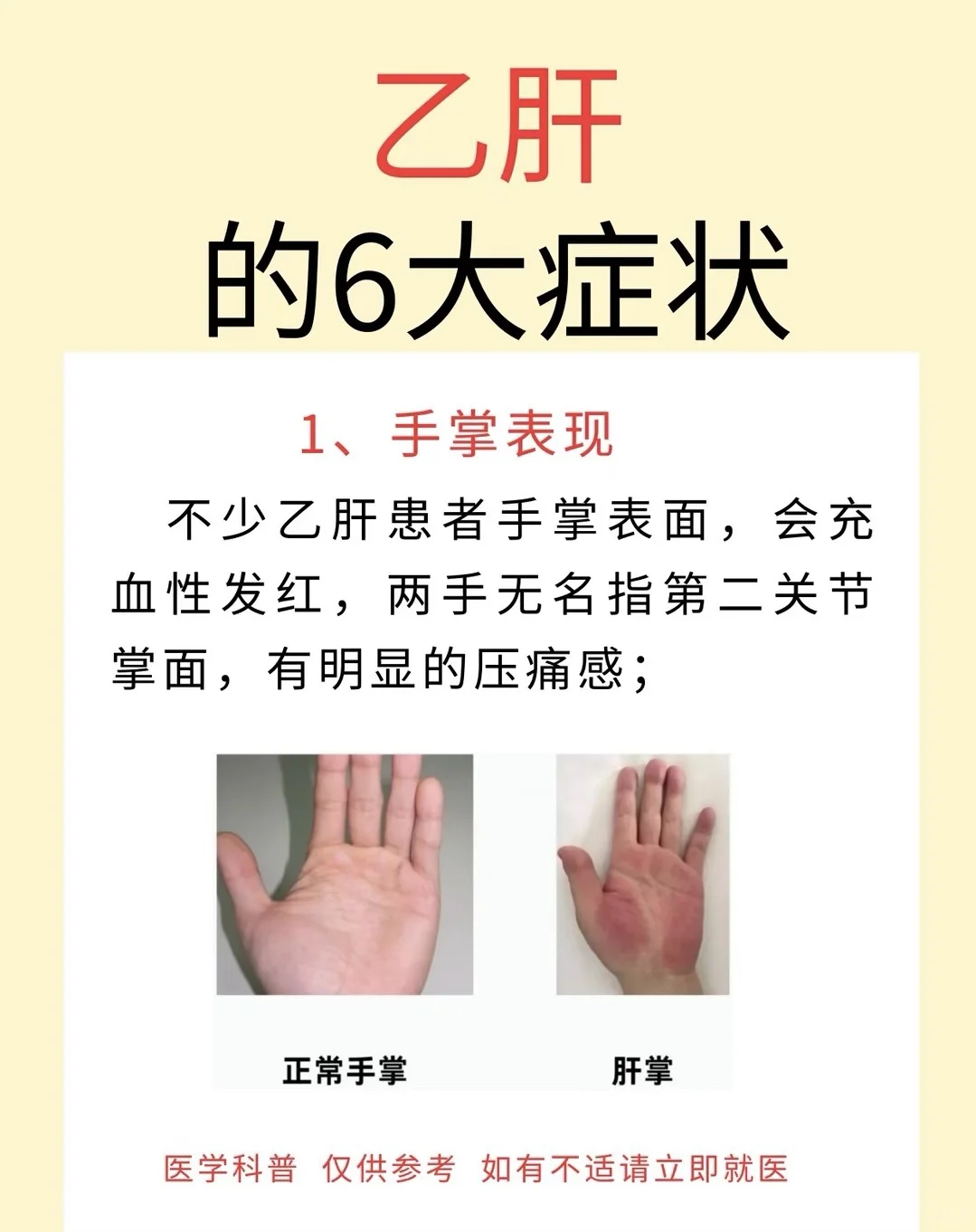 乙肝6大症状，有哪些~﻿山东﻿ ﻿健康科普﻿ ﻿乙肝﻿ ﻿乙肝大三阳﻿ ﻿