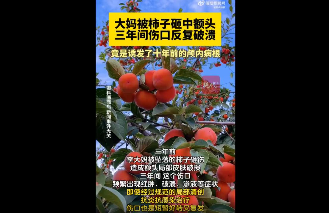 近日，南京江北医院接诊了一例特殊的疑难病例。三年前，李大妈被高空坠落的柿子砸中