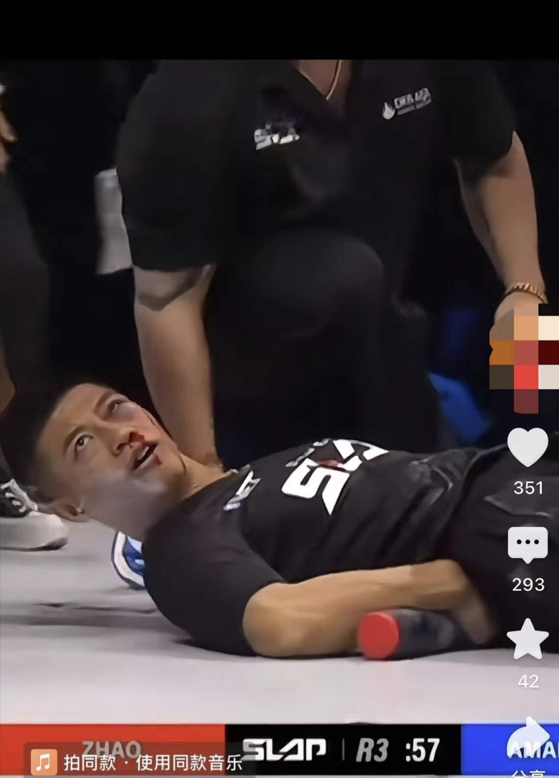 赵鸿刚参加世界职业扇耳光大赛被Ko。眉角受伤，眼睛淤青，本人报平安：没啥事，