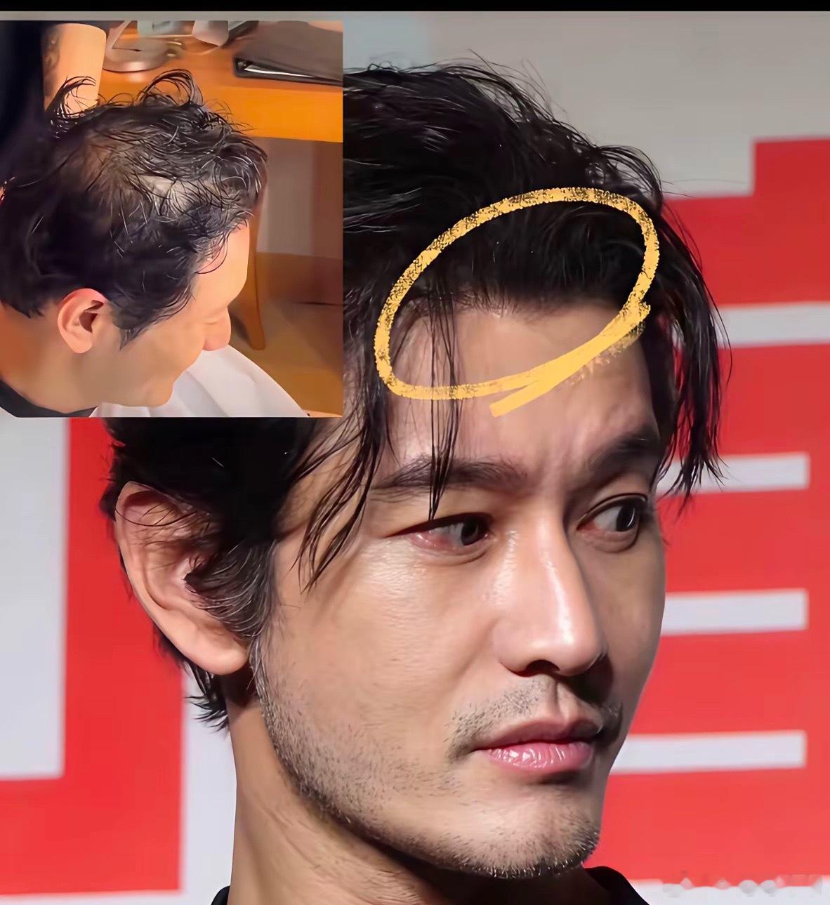 别的不服，就服黄晓明的发量！​​​