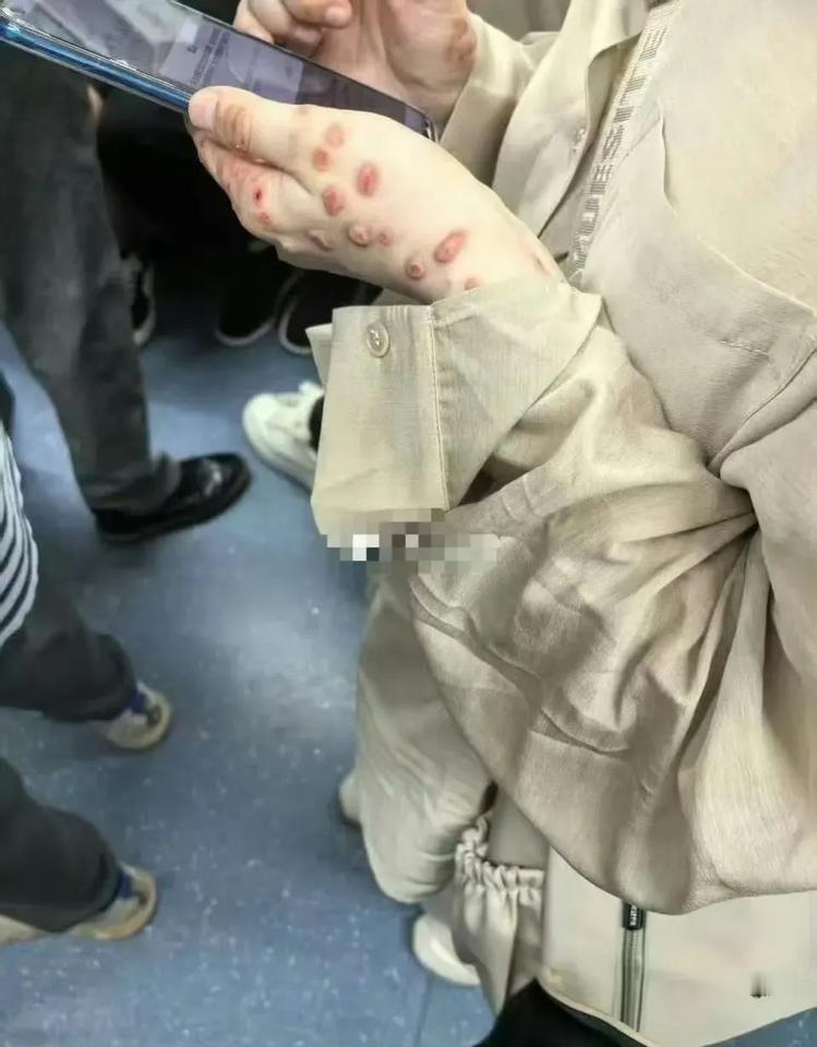 好吓人，这手是怎么了，啥病啊。