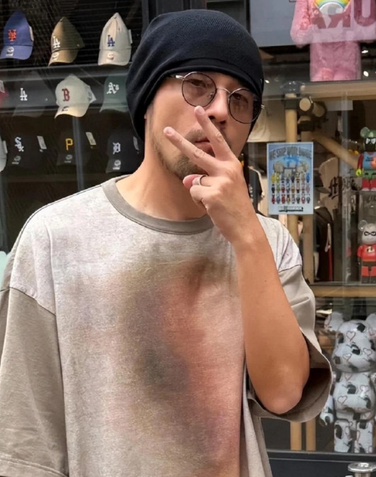 46岁的周杰伦旧病复发被人拍到，强直性脊柱炎将他折腾的判若两人，弯腰驼背如同七八