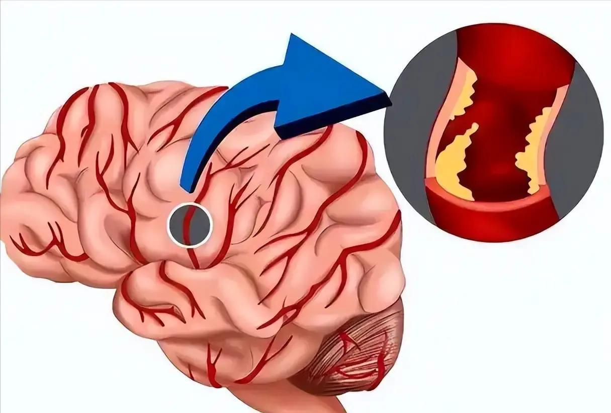 2026年2月初，北京60岁退休老人张大爷坚持每天清早出门散步两小时，结果回家门